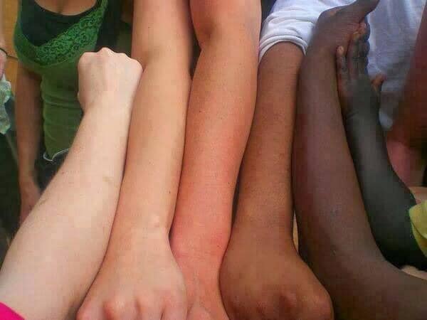 arms